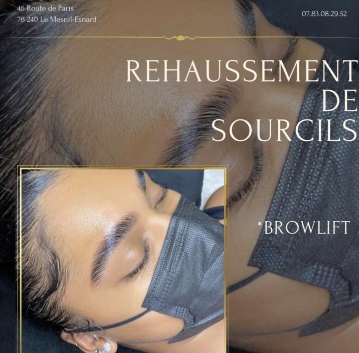 Lipocavitation Rouen