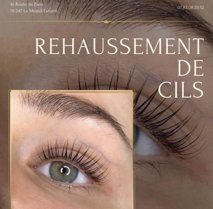 Lipocavitation Rouen