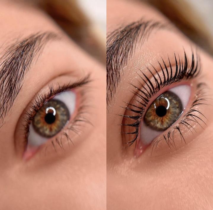 Séances d’épilation Rouen