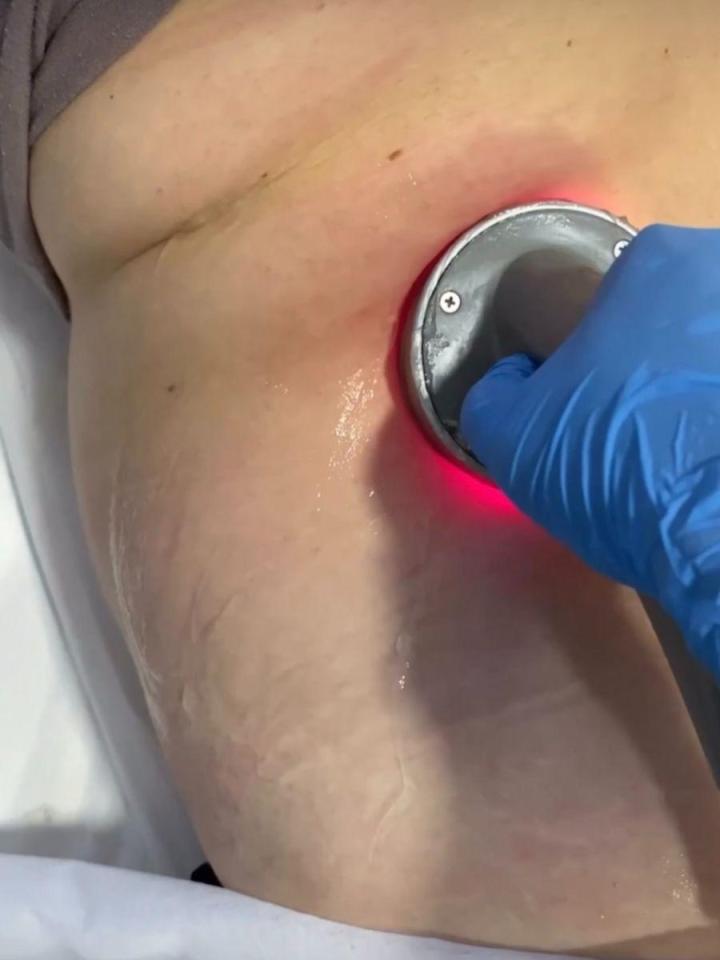 Esthéticienne spécialisée dans la lipocavitation Rouen